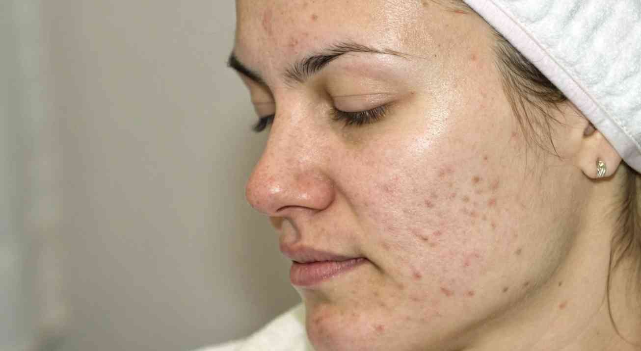 Resultados visibles y progresivos