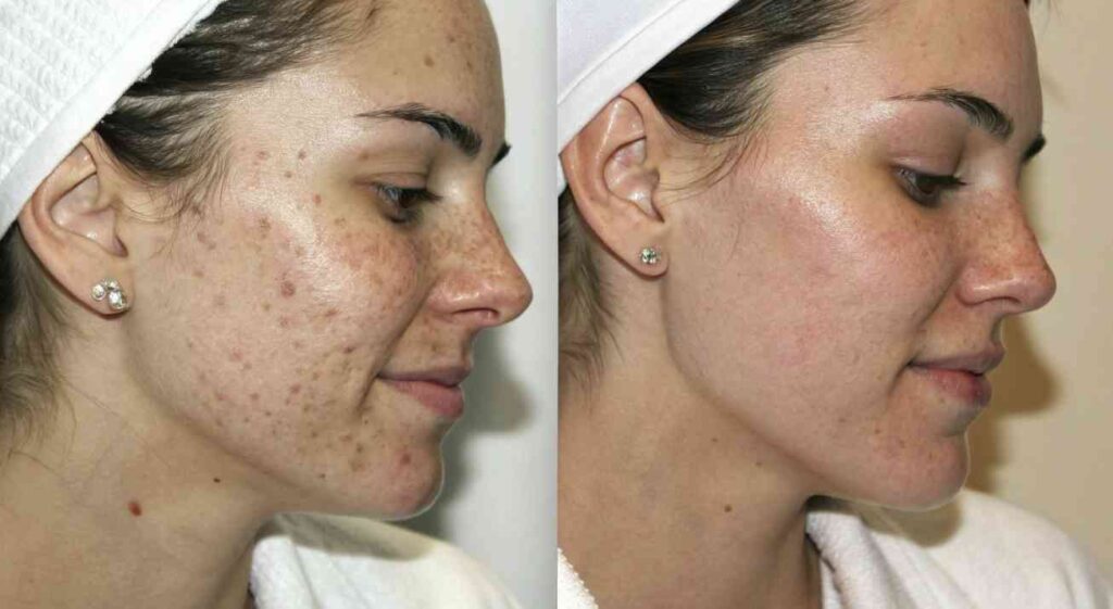 Tratamientos faciales